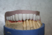 WAX UP Моделирование зубов из воска